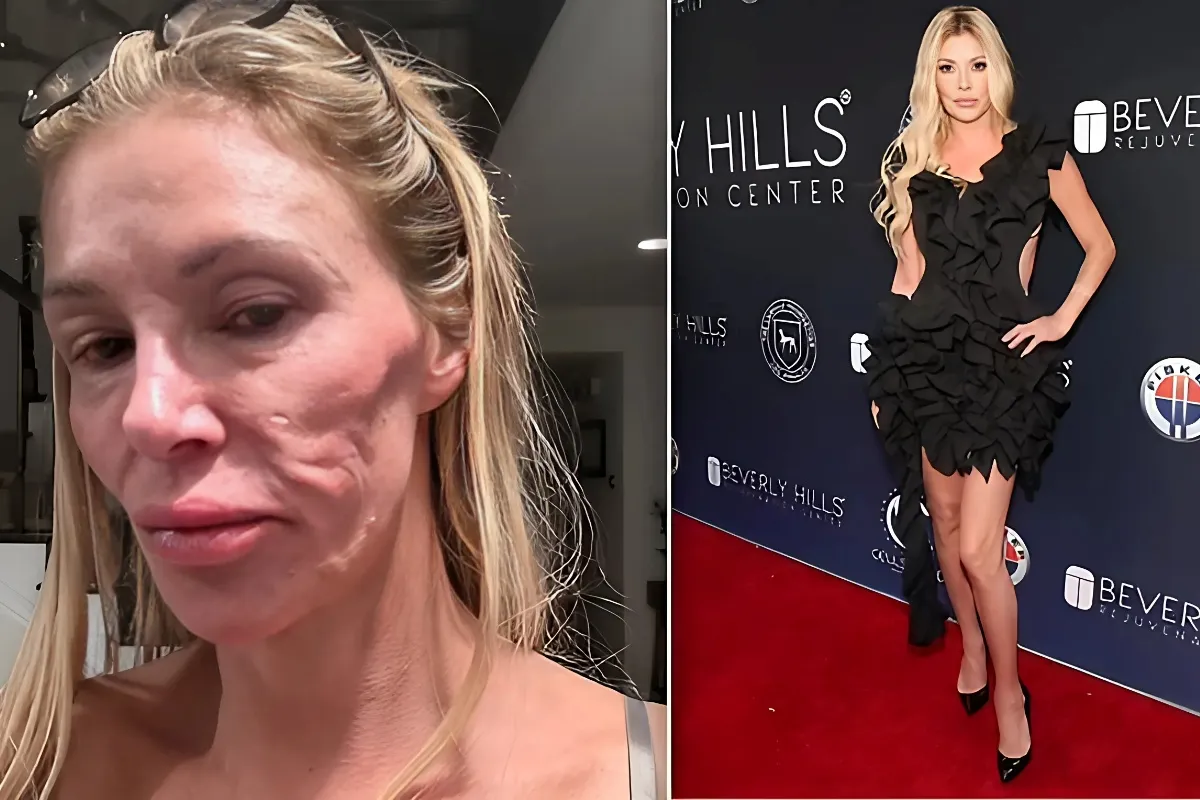 Brandi Glanville's Startling Transformation: Unrecognizable in Latest Selfie Due to Health Condition - lulu