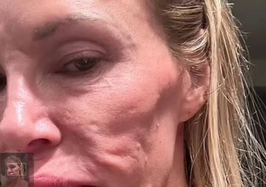 Brandi Glanville looks unrecognizable in new selfie due to shocking health condition