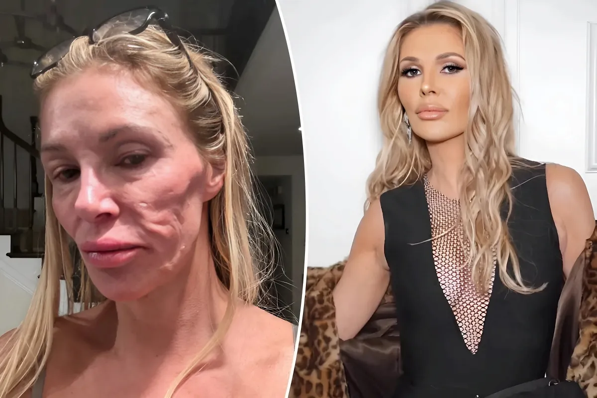 Brandi Glanville says doctors believe facial disfigurement could be from parasite that ‘jumps around’ her face