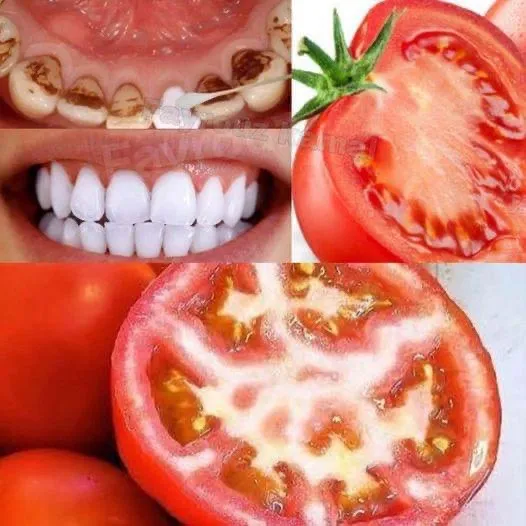 Brighten your smile naturally: Tomato teeth whitening