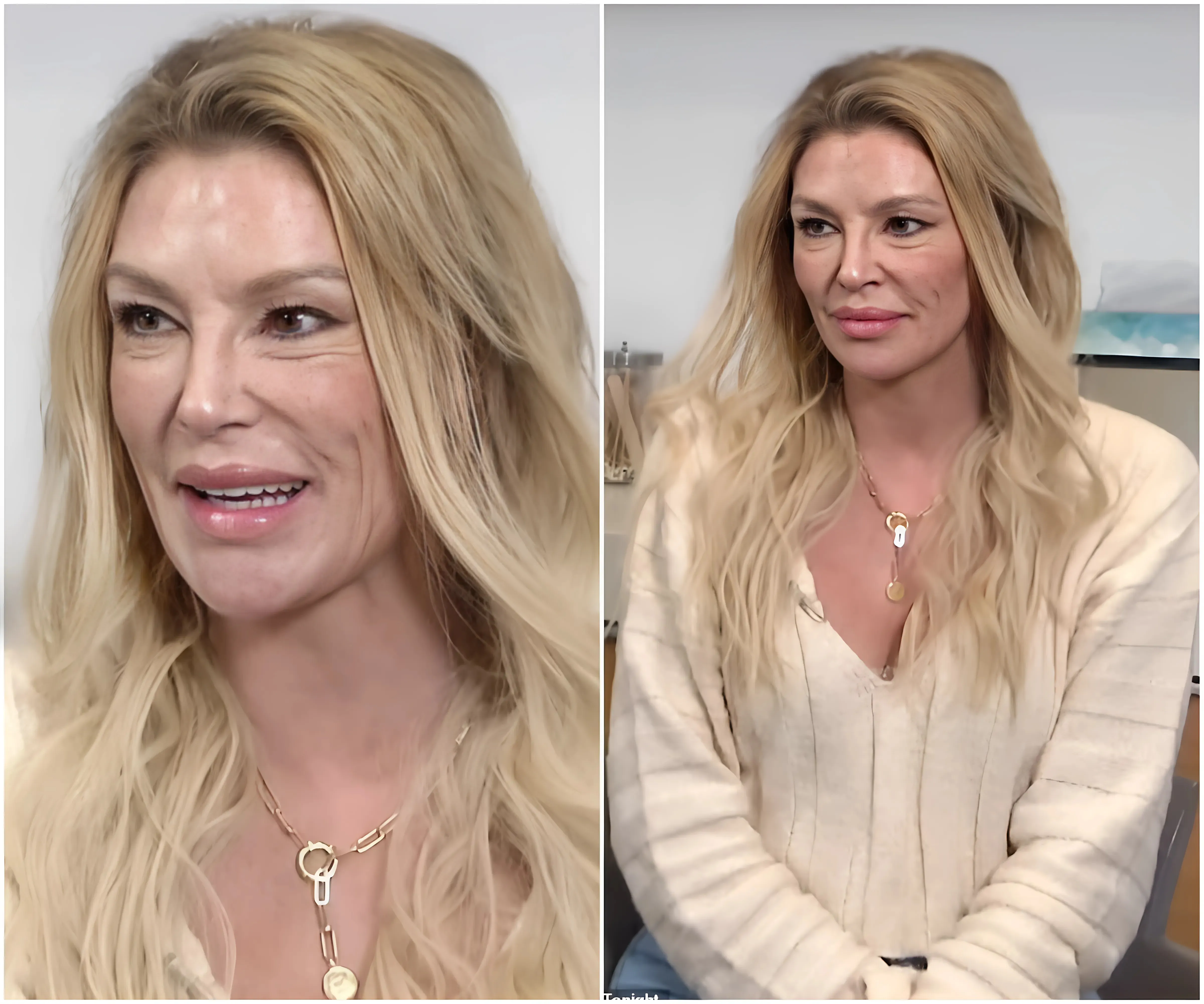 Brandi Glanville, 52, reveals she has spent $70K trying to get rid of the Mexican 'parasites' in her face - suong