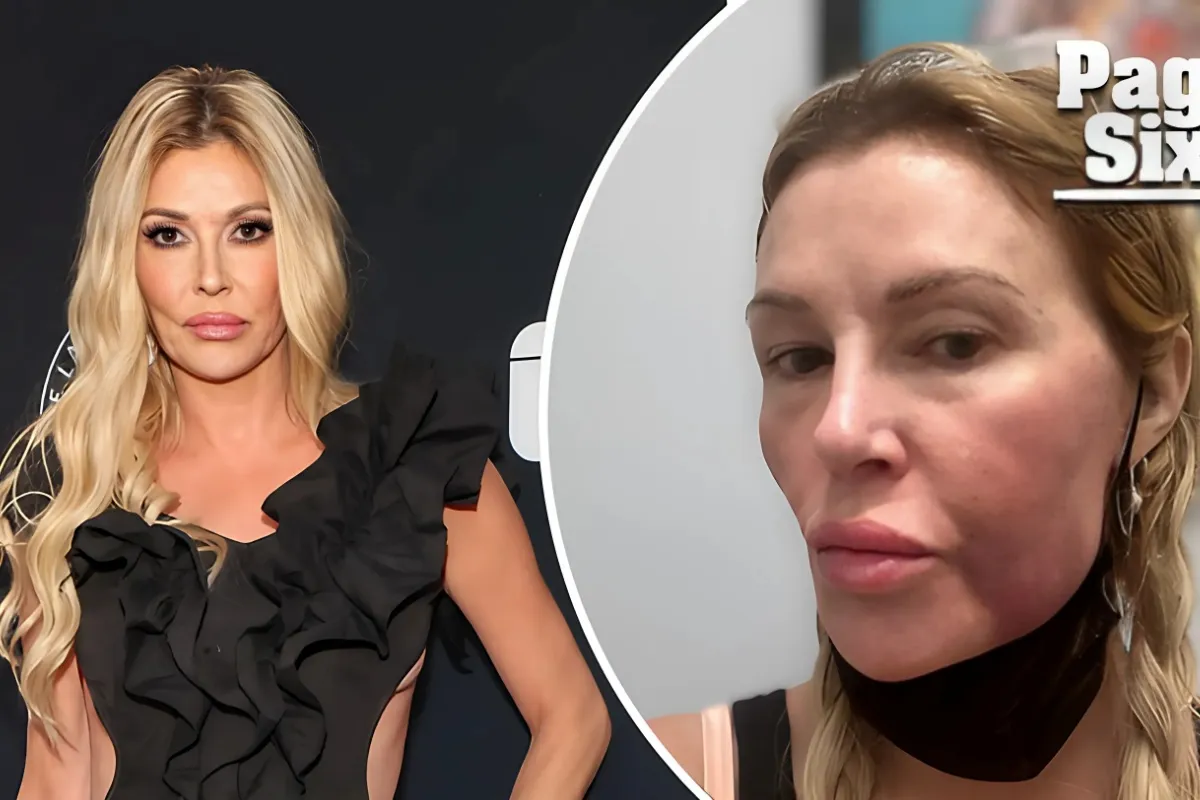 Brandi Glanville's Quest: Over $70K Spent in Pursuit of Unraveling the Mystery Behind Her Facial Disfigurement - lulu