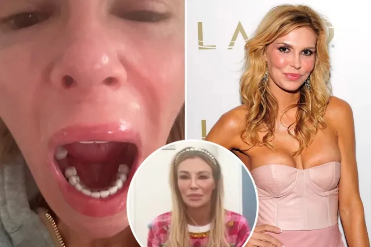 Brandi Glanville loses 5 teeth from stress, infection and swelling disease- but she’s ‘determined to get her smile back’