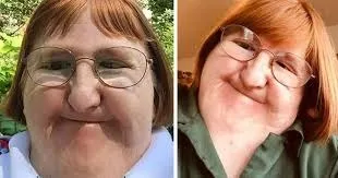 9. Disabled woman told she's ”too ugly” to take pictures refuses to be bullied by trolls – fights back with selfies