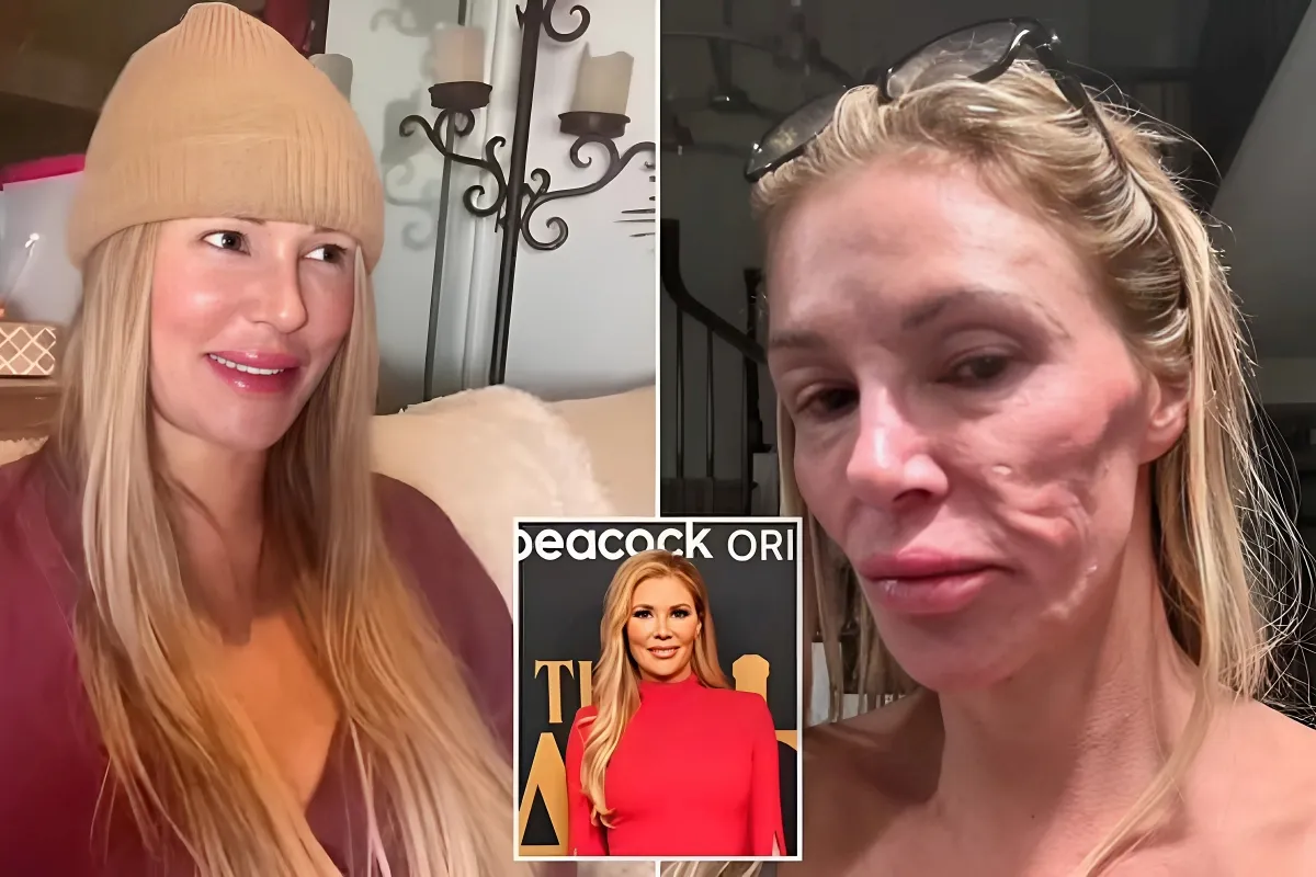 Brandi Glanville using facial 'parasite' to help make money on Cameo after being dropped from Bravo