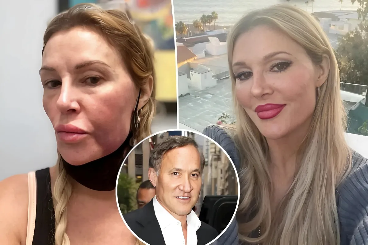 Brandi Glanville says she has ‘zero drama’ with Dr. Terry Dubrow after plastic surgeon calls her face a ‘ticking time bomb’