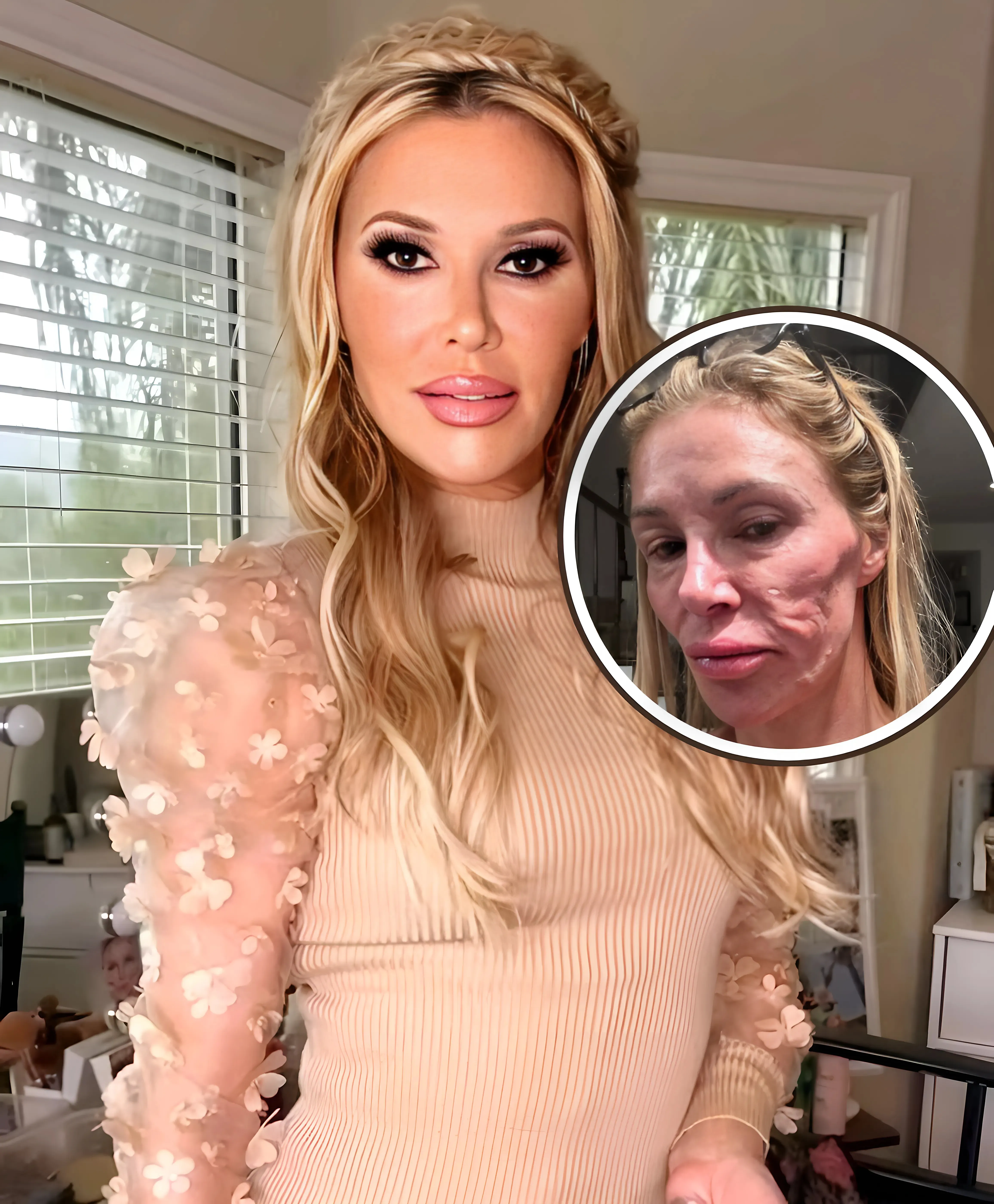 PHOTO: RHOBH’s Brandi Glanville Gets a New Smile After Losing 5 Teeth Amid Illness as Dr. Terry Dubrow Explains What’s Wrong With Her Face and Says She’ll Likely Need Surgery, See Her Response to Him