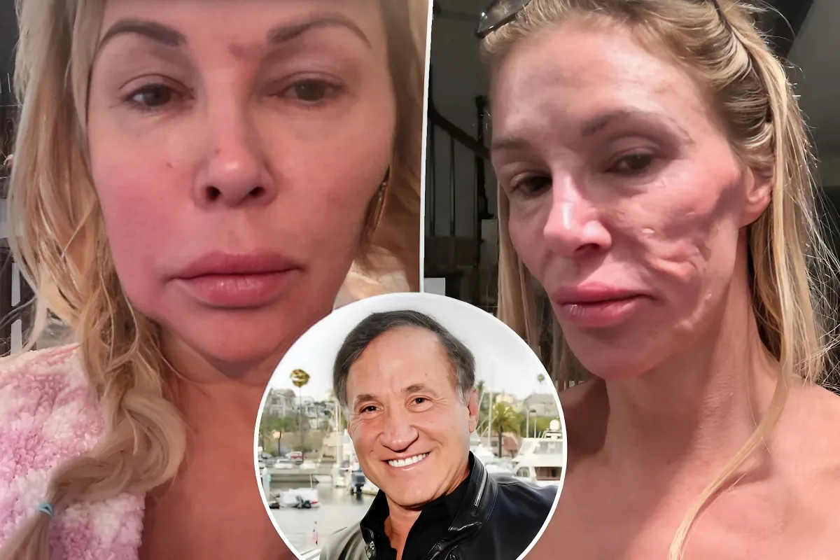 Dr. Terry Dubrow calls Brandi Glanville’s face a ‘ticking time bomb,’ offers help