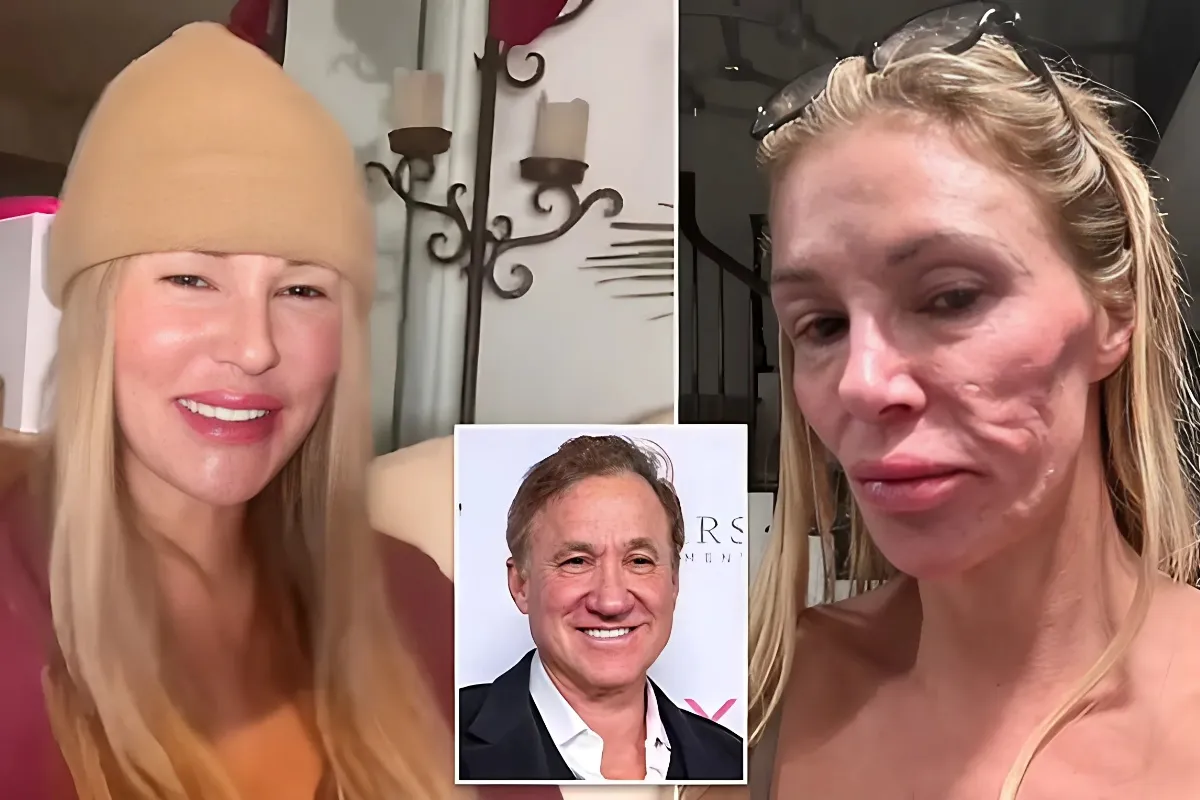 Brandi Glanville and Dr. Terry Dubrow: A Drama-Free Dynamic as Plastic Surgeon Warns of a 'Ticking Time Bomb' in Her Face - lulu