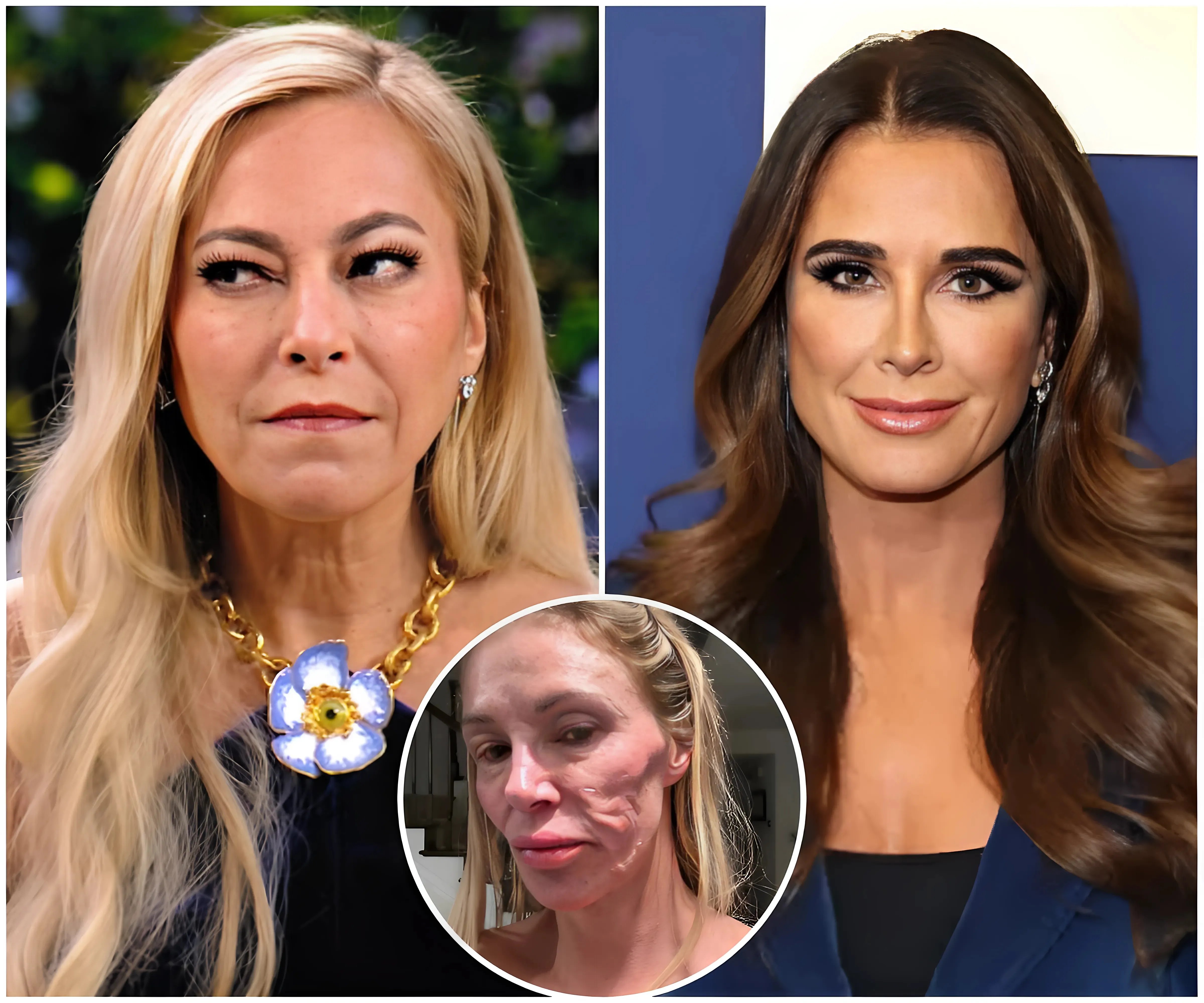 Sutton Stracke Criticizes Kyle Richards For Sarcasm About Brandi Glanville's Face – RHOBH Drama Explodes After Revelation About Illness!