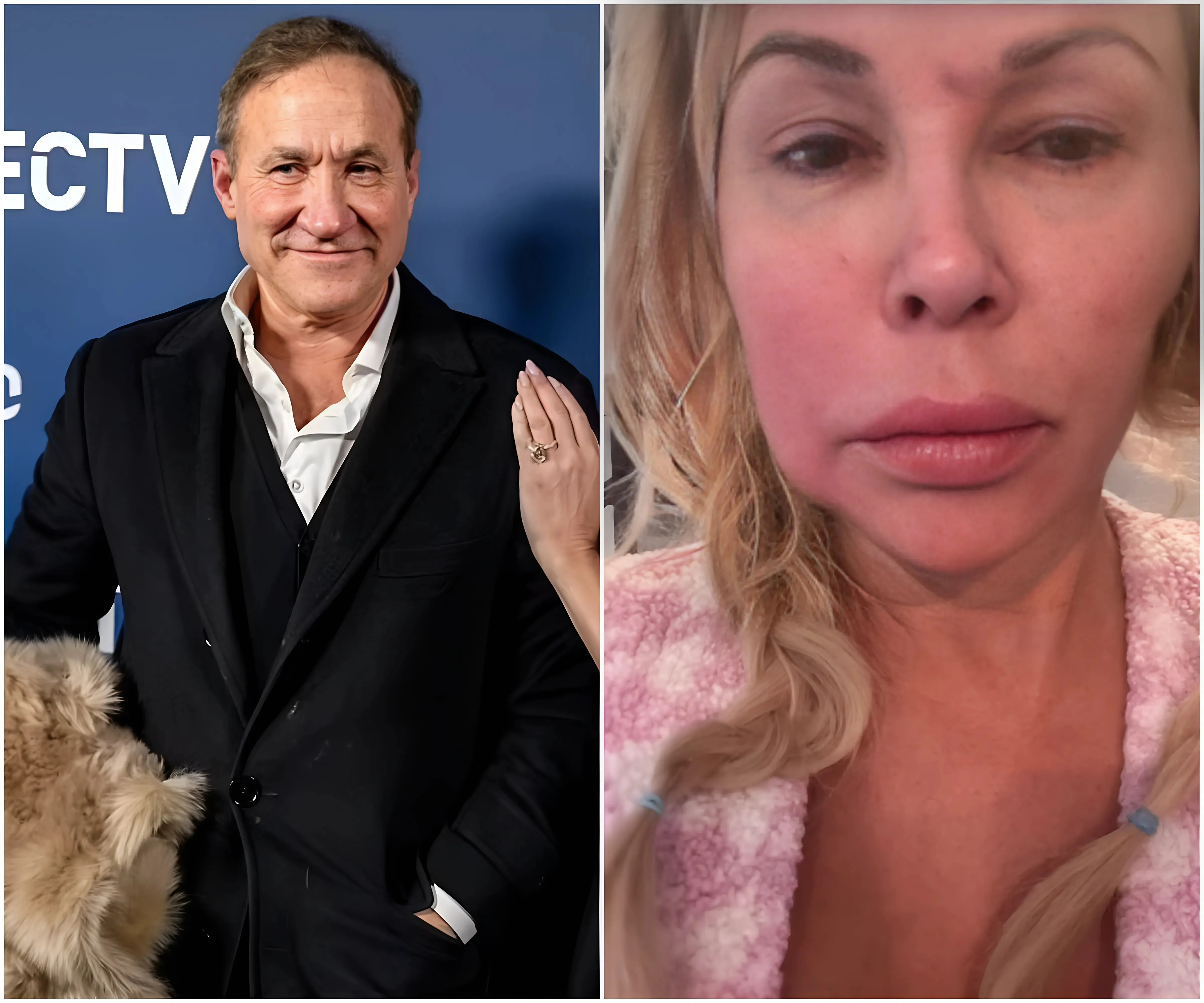 Brandi Glanville delivers a shocking clapback after Dr. Terry Dubrow likens her face to a 'ticking time bomb,' with a SIX-WORD response that stuns everyone - suong