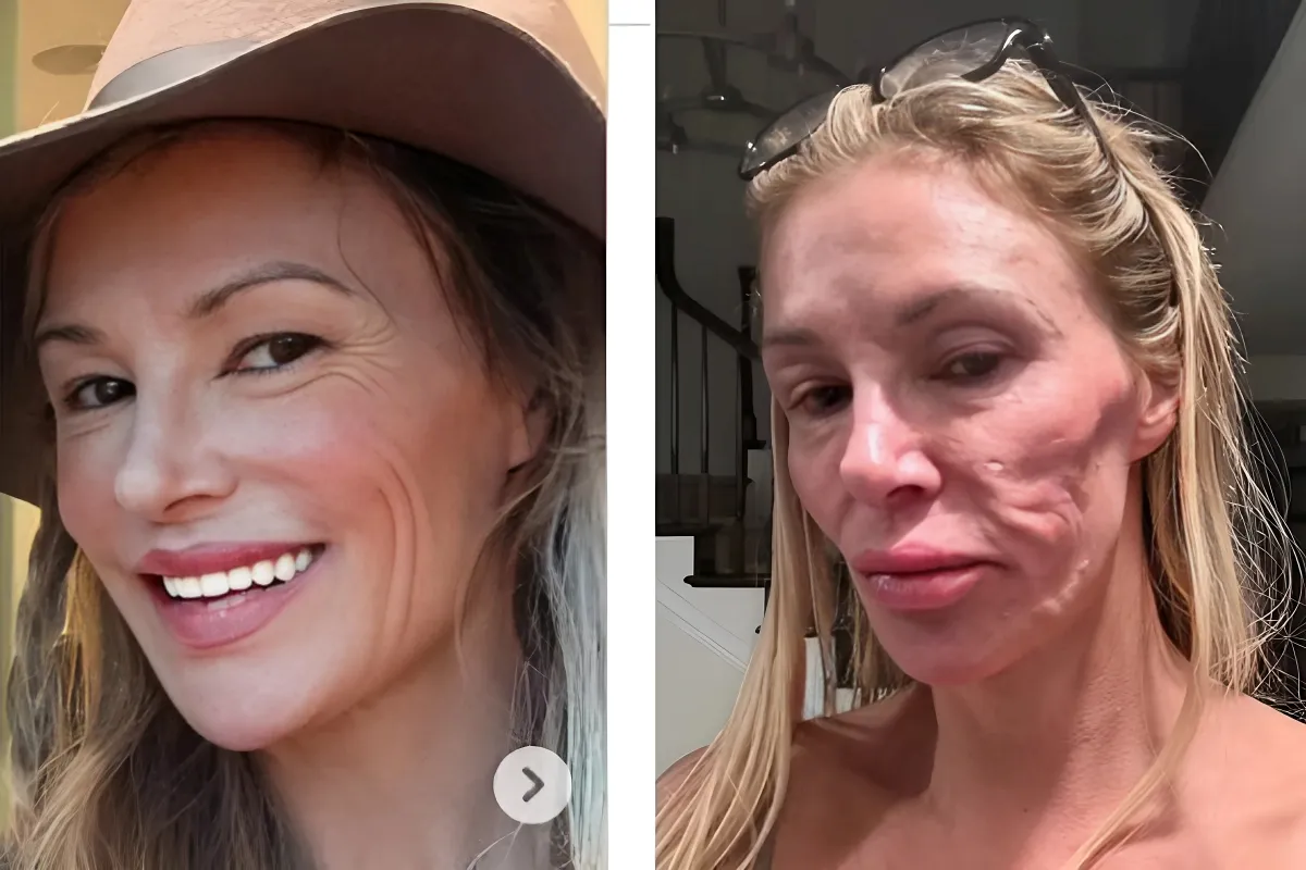 Brandi Glanville, 52, looks unrecognisable as she leaves fans stunned by her dramatically taut visage in latest health update - after 'parasite' left her disfigured