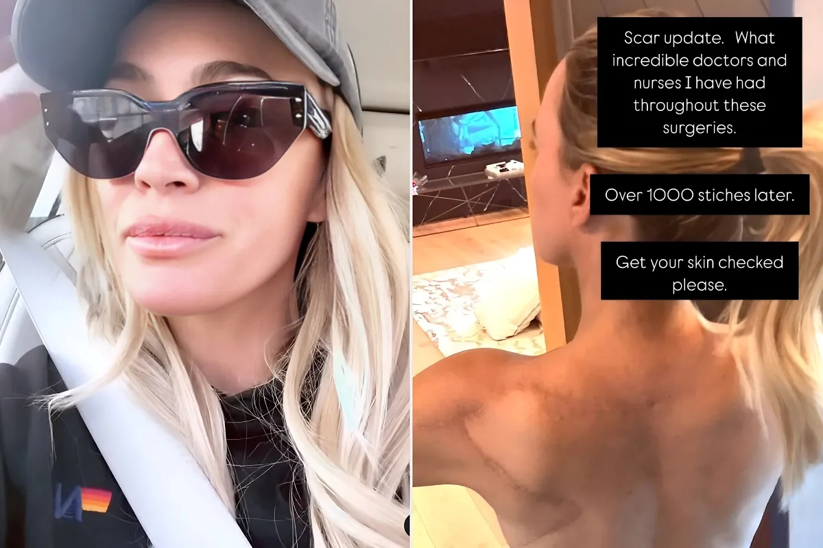 Teddi Mellencamp Cries Tears of Joy After Latest Skin Check Will Not be Biopsied for the First Time in 2 Years: ‘Such a Good Feeling’