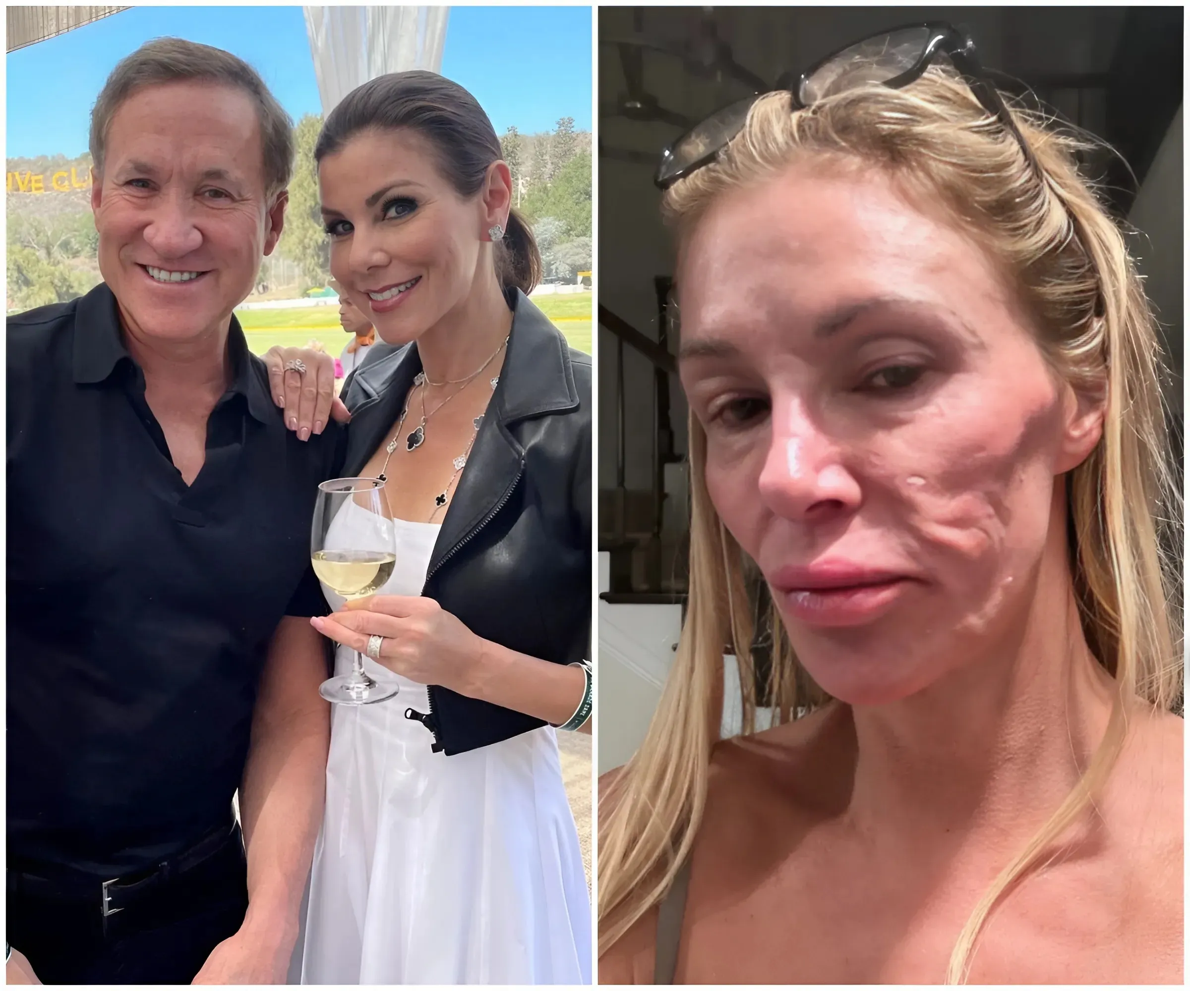 "Heather Dubrow Shocks With Reveal: Her Husband, Dr. Terry Dubrow, Reveals Brandi Glanville's Horrifying Disease – Can It Be Cured And How Much Does It Cost?"