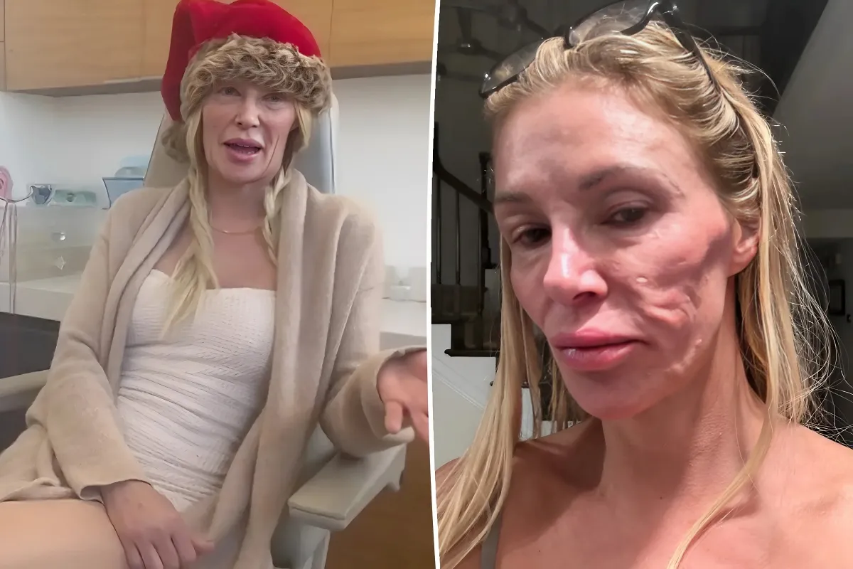 Brandi Glanville Opens Up: Raw and Revealing Insights on Her Struggle with a Debilitating Facial 'Parasite - lulu