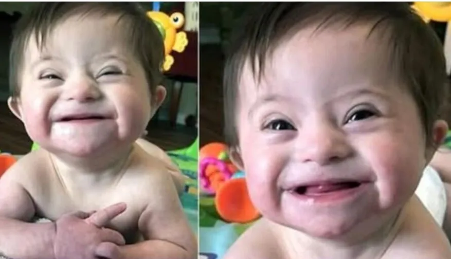 5. Viral Video of Adopted Baby with Down Syndrome Smiling for Her New Mom Warms Hearts Worldwide