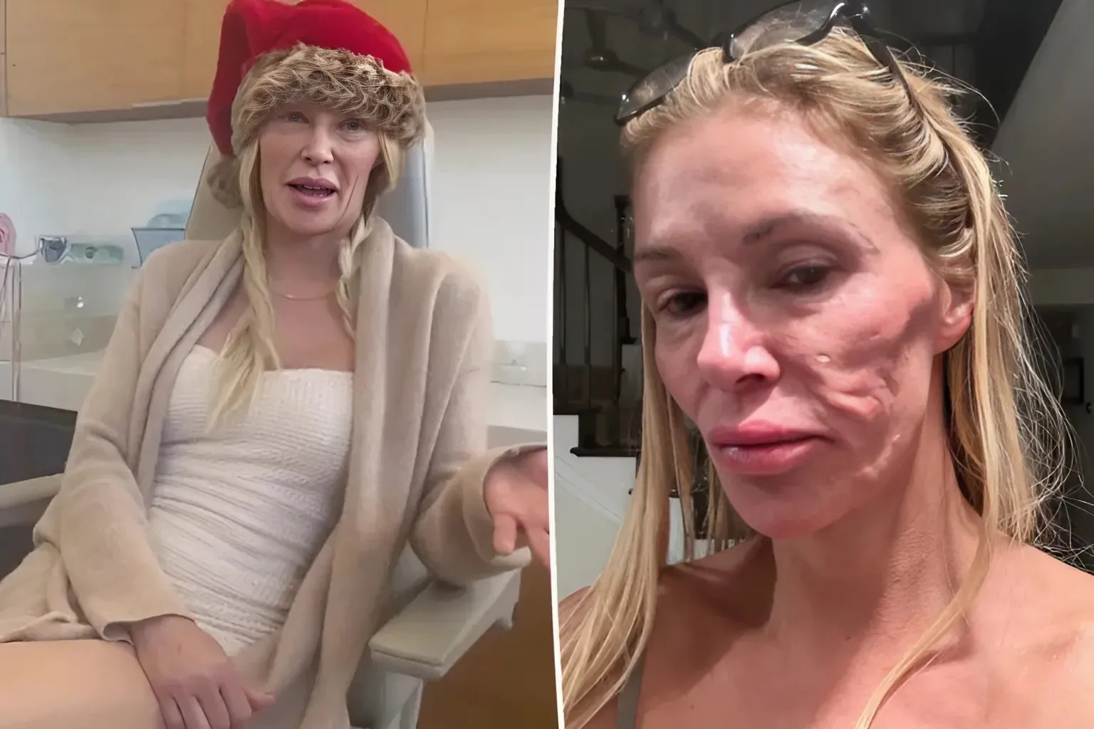 "Brandi Glanville's Shock: Tearful Confession About 'Parasite' That Devastates Her Face"