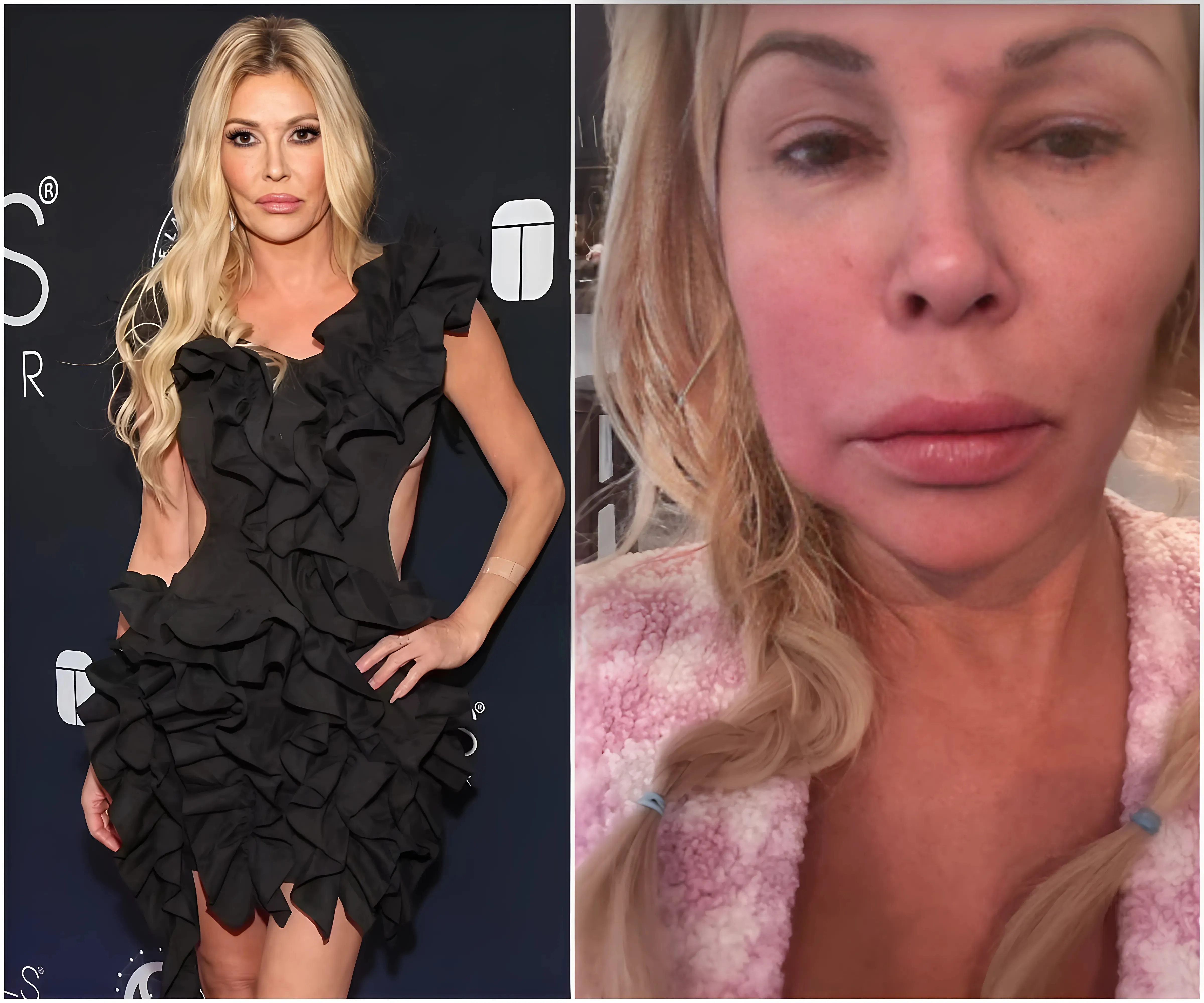 Brandi Glanville talks suffering 'deep depression' while battling facial disfigurement: 'I look like a crackhead'