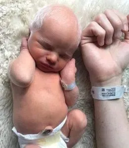 P1. Baby mocked for having white hair – years later, he looks perfectly happy and healthy