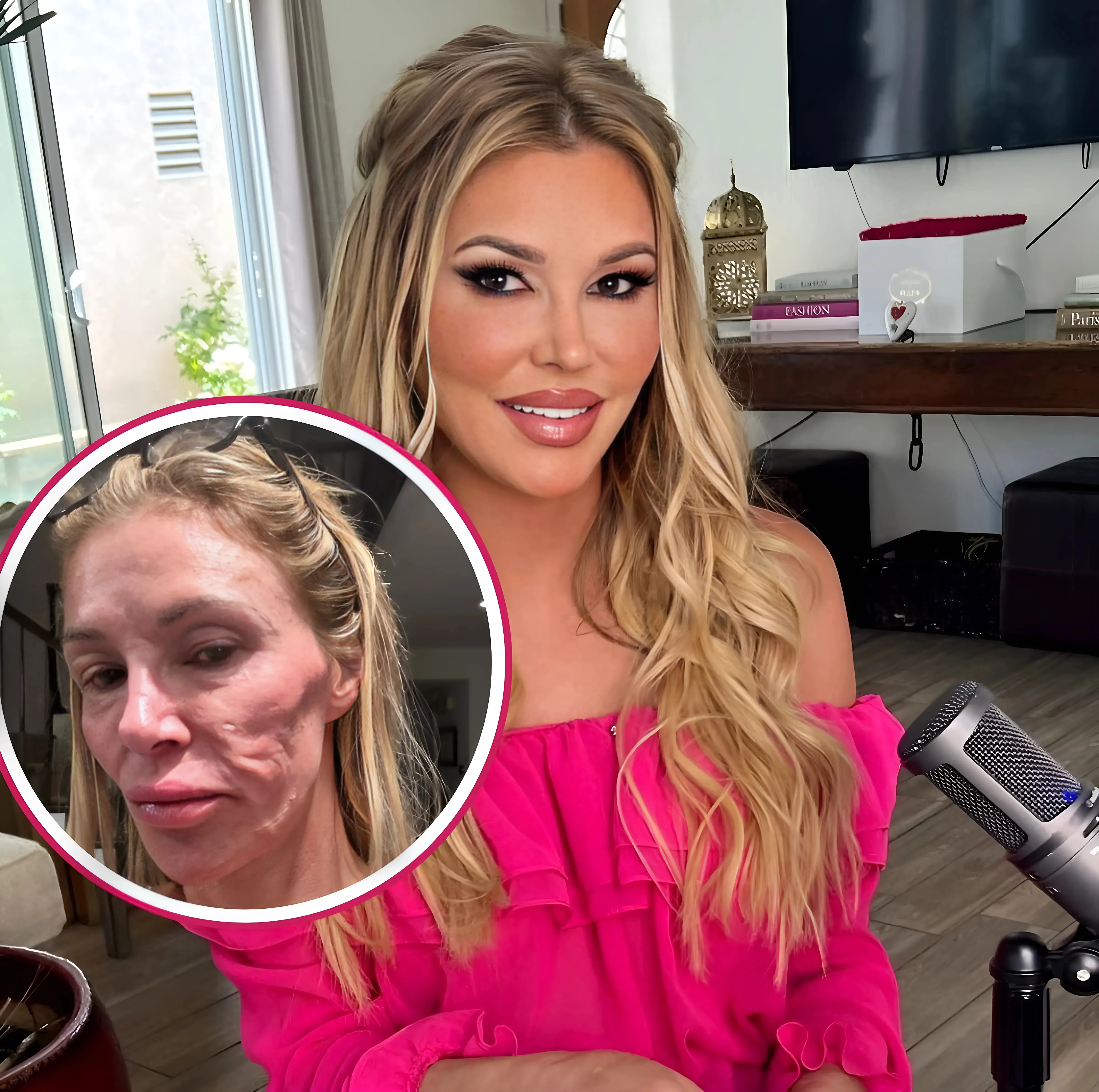 Brandi Glanville Offers Update on Face Amid Health Crisis as She Compares Herself to a “Crackhead” & Admits to Bouts of Depression