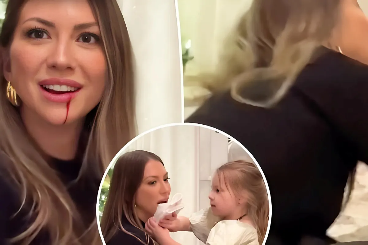 Stassi Schroeder gets a bloody lip after daughter, 3, accidentally hits her with a toy broom: ‘Is it really that bad?’ - lulu