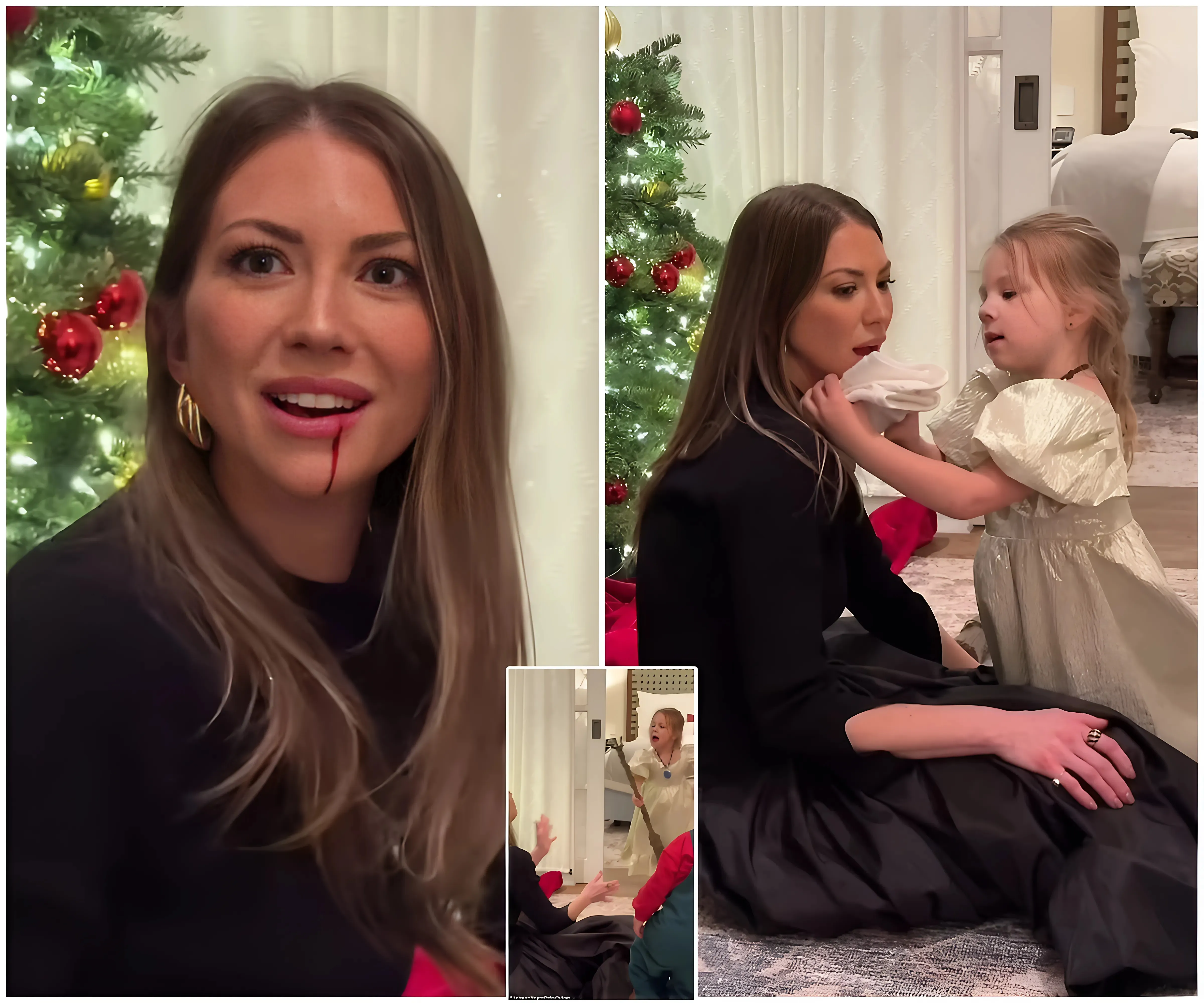 Stassi Schroeder left BLEEDING after daughter Hartford, three, cut her face with toy broom