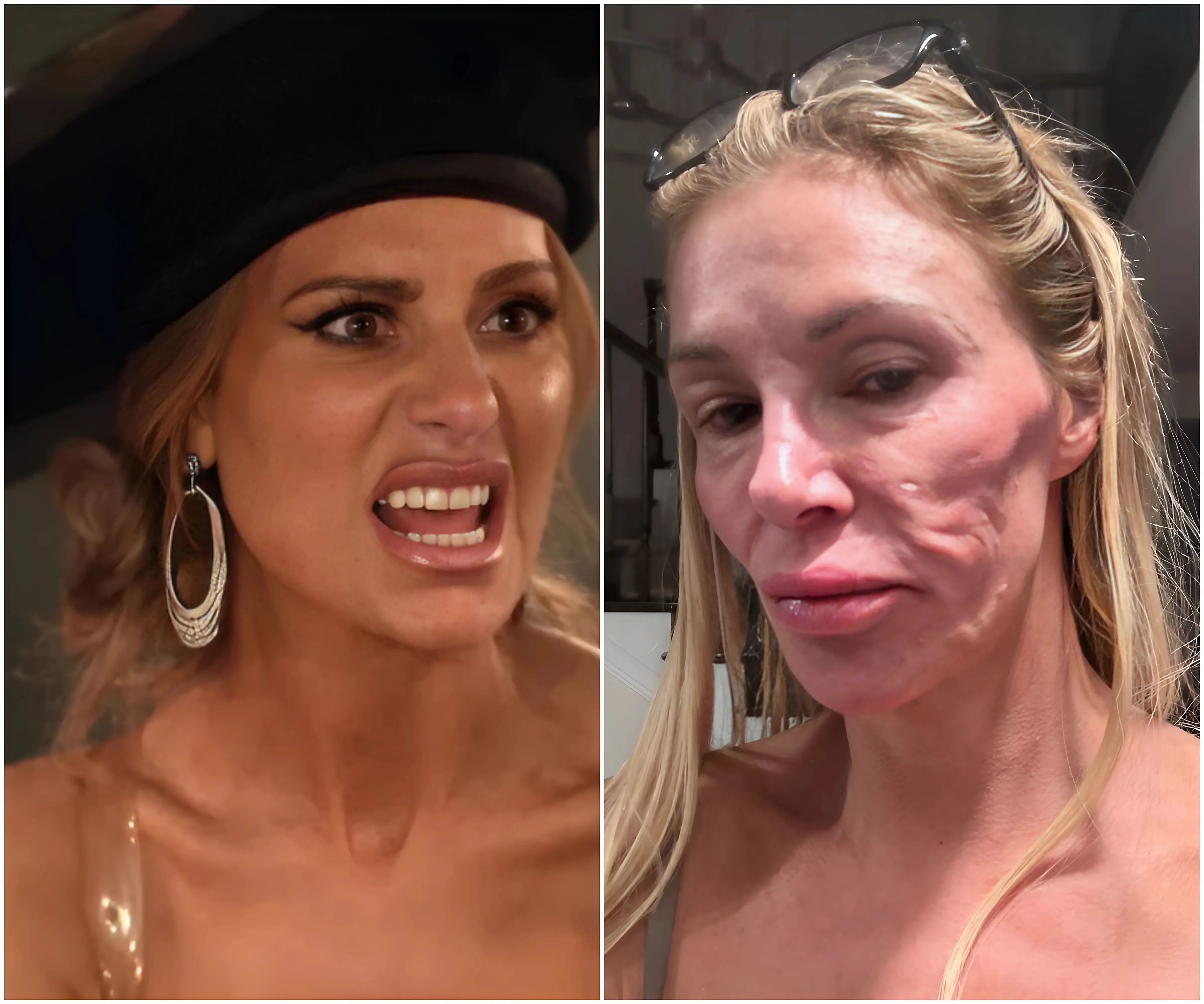 Dorit Kemsley ‘Exposes’ Brandi Glanville: Bentley Drama Peaks as Shocking Facial Deformity Secret Unveiled! Tensions Soar Amid LA Mansion Foreclosure Threat! - suong