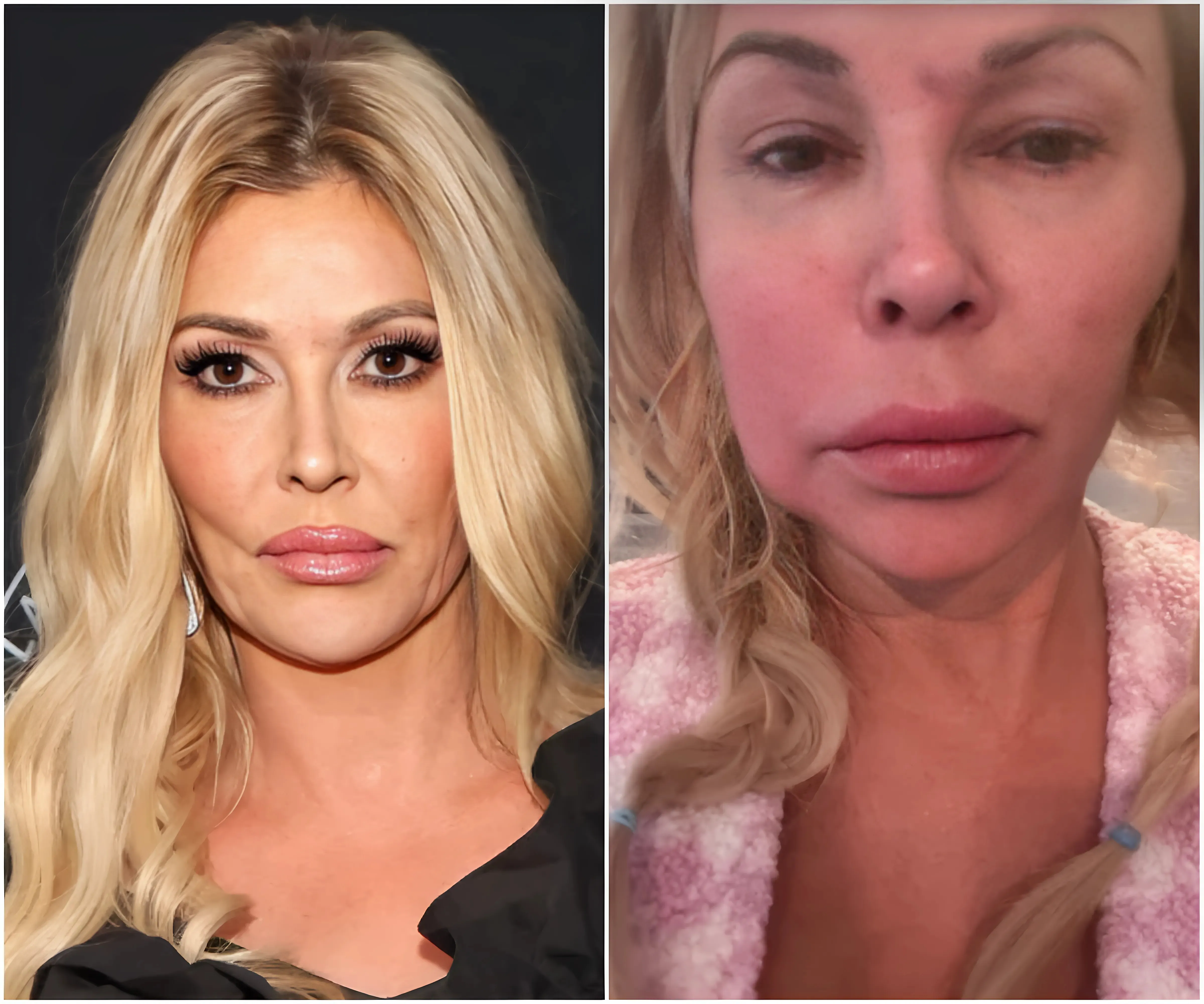 Brandi Glanville Says She Hasn’t Had Sex Since 'Last October’ Due to Facial Disfigurement - suong