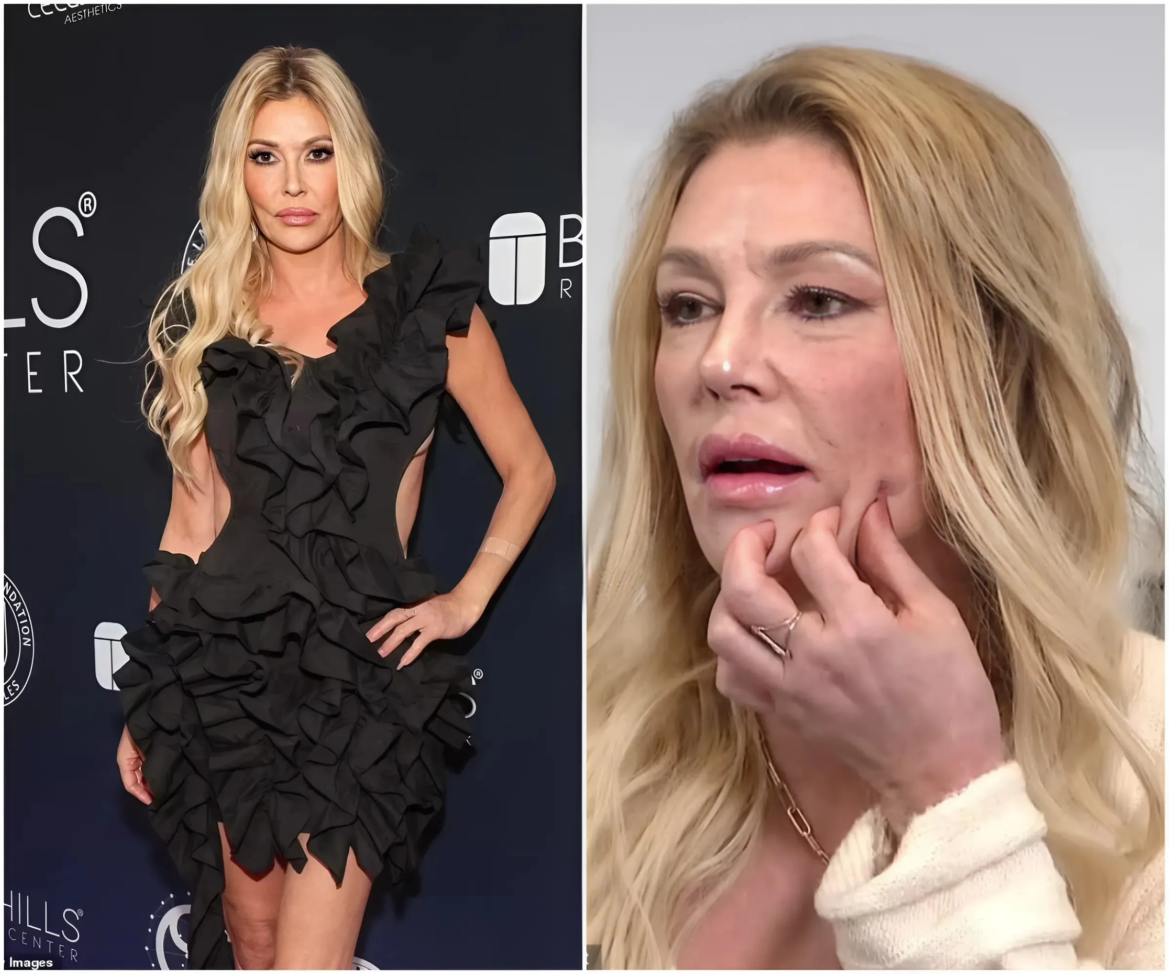 Brandi Glanville hasn’t had sex in over a year due to facial disfigurement: ‘I haven’t kissed or made out with anyone’