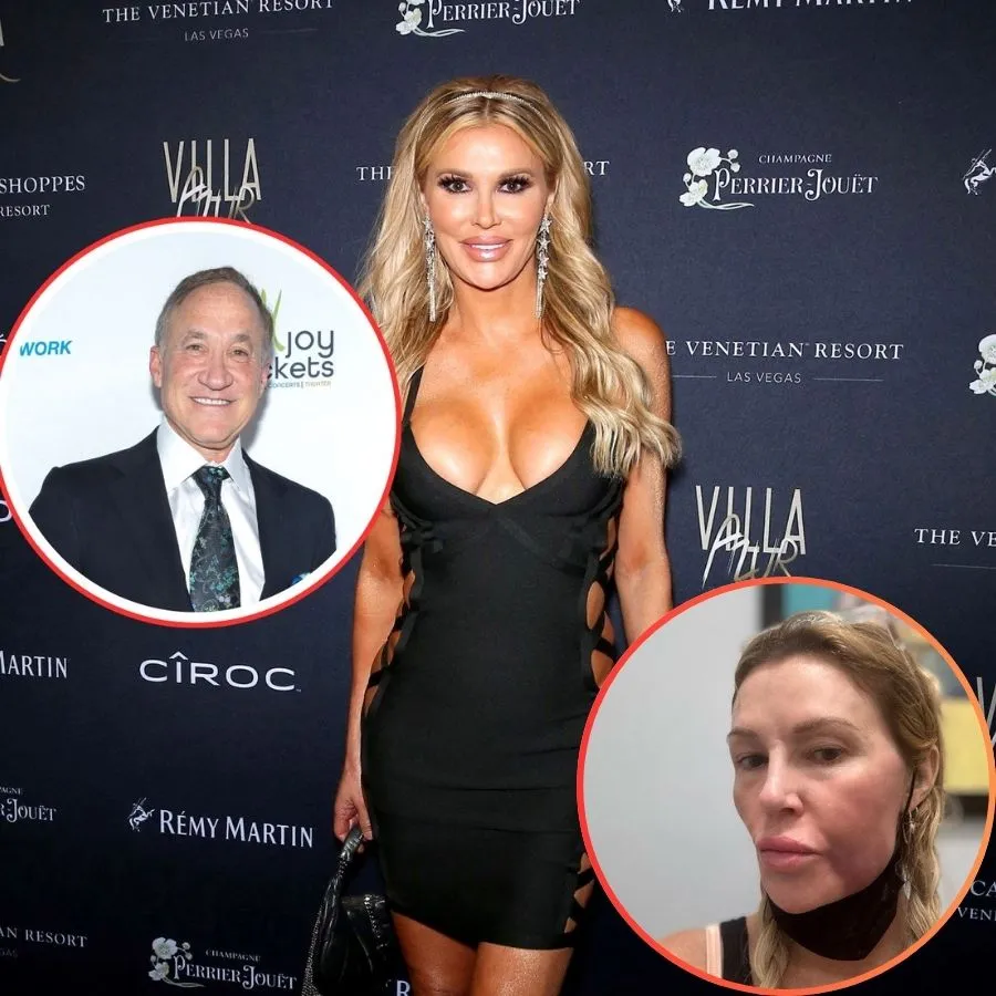 Brandi Glanville Shares Update With Dr. Terry Dubrow Amid Facial Disfigurement, Plus Says She Hasn’t Had Sex in Over a Year & Asks Fans to Be “Kinder”