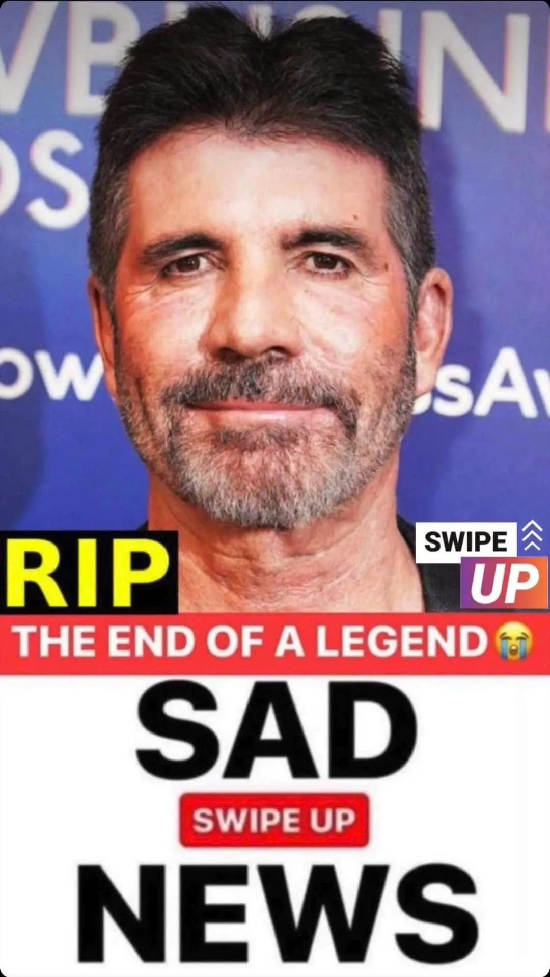 ST. 0 Simon Cowell criticized, left with a permanently “sad face” after years of botox