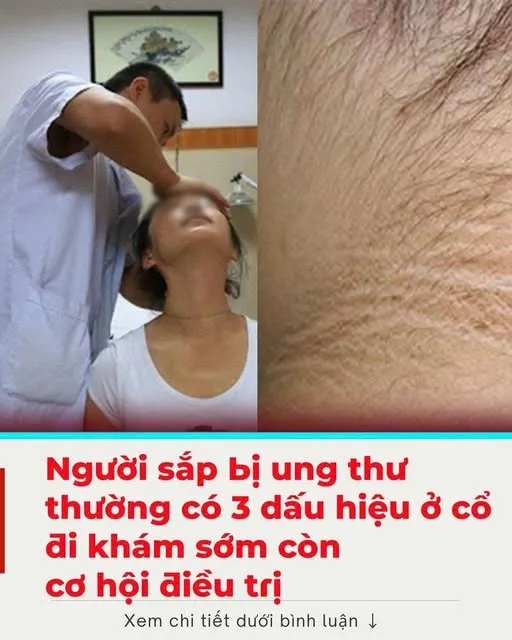 Người sắp bị u:ng thư thường có 3 dấu hiệu ở cổ, đi khám sớm còn cơ hội đ:iều trị