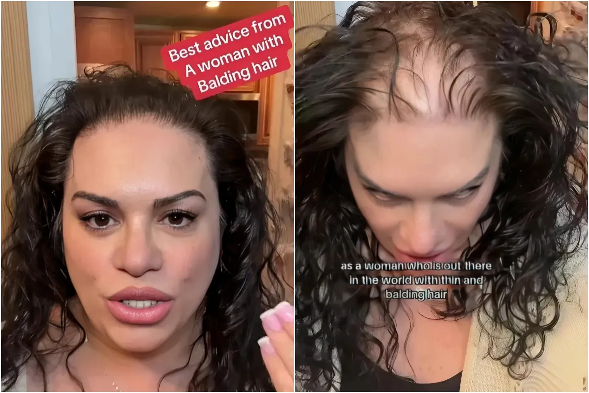 I was sick of everyone staring at all the bald patches on my scalp – now I have a 1-minute hack for instantly thick hair ngocc