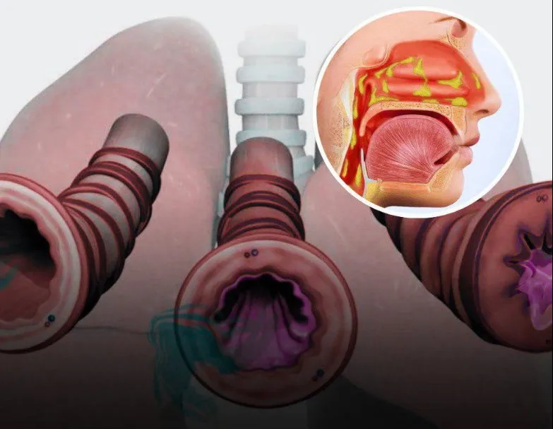 5. How to maintain a healthy level of phlegm and mucus