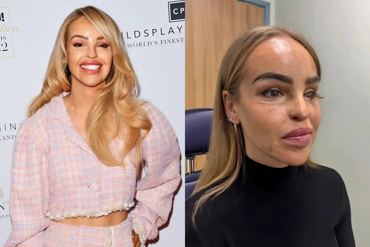 Katie Piper shares emotional health update after eye surgery as she says she’s finally ‘reached the end of... ngocc