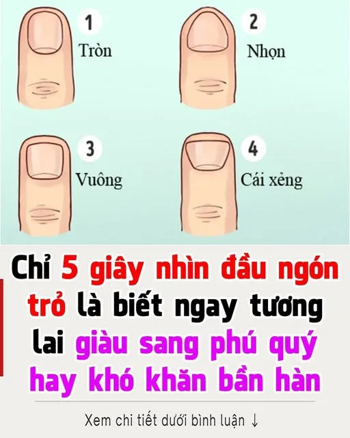 Đàn bà có ngón tay kiểu này đích thị "mệnh giàu số sướng", tiền tỷ trong tay, cư.ớp sạch vận may thiên hạ