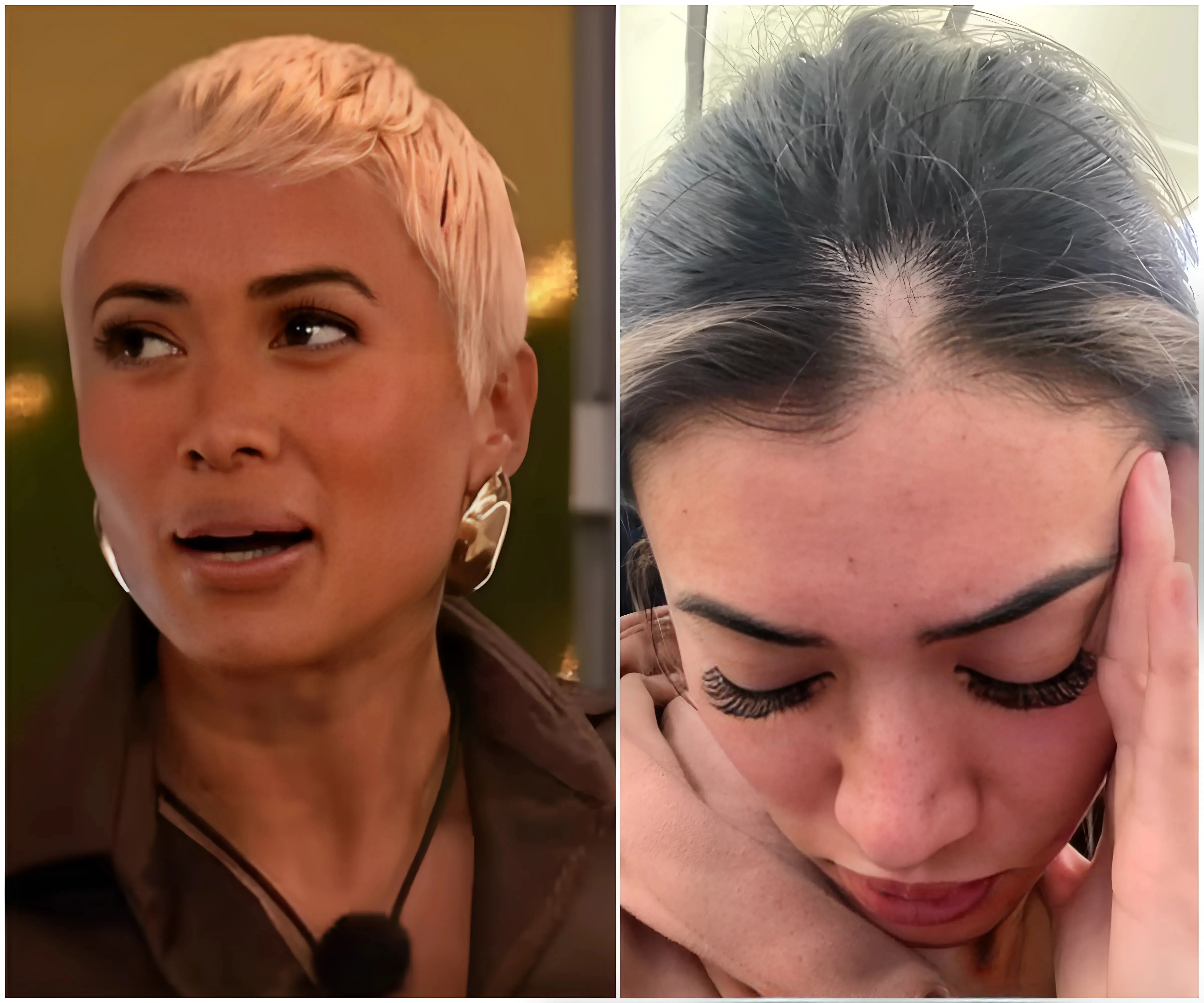 Love Island's Kaz Crossley speaks out on her alopecia battle after 'stress' from being held in a Dubai prison led to hair loss - suong