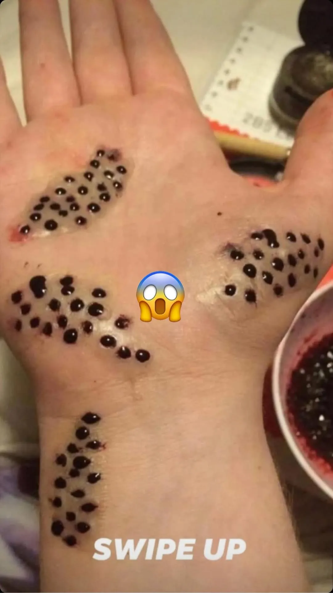 ST, 0 SKIN blackhead treatment