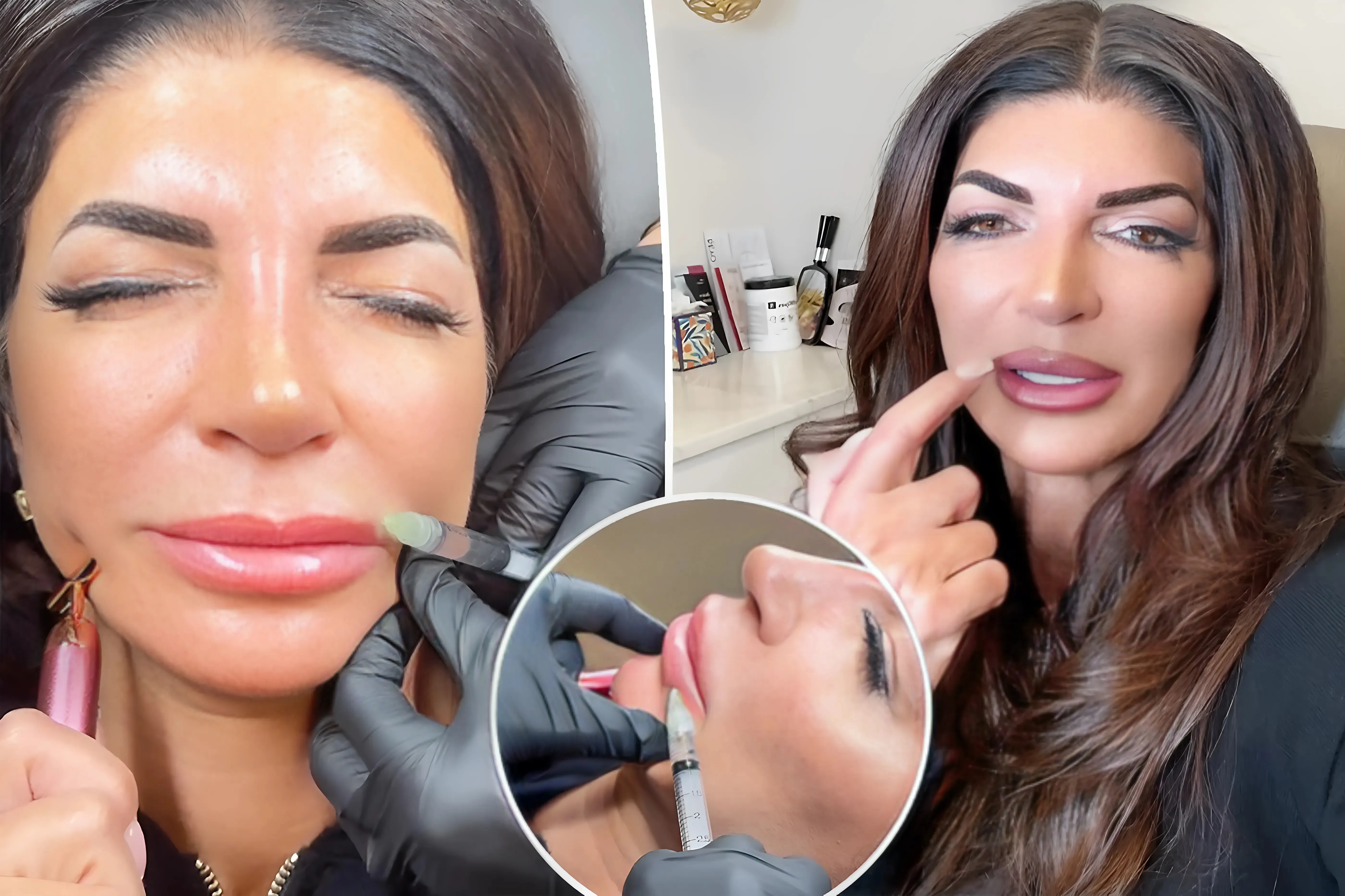 Teresa Giudice Embraces Natural Beauty: Watch as Reality Star Dissolves Lip Fillers in Raw Video Amidst Criticism trucc