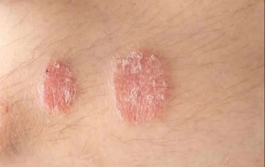 3. Warning signs you should never ignore on your skin s2 3. Warning signs you should never ignore on your skin s2