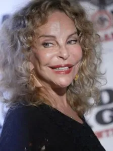 F. She was once a favorite of millions thanks to her unusual appearance, but has changed dramatically due to plastic surgery.