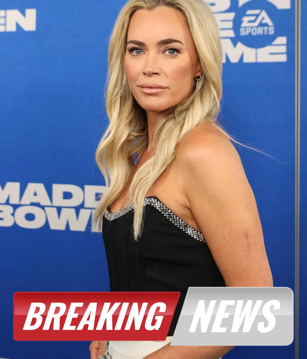 Teddi Mellencamp Has ‘Turned the Corner’ Following Brain Surgery