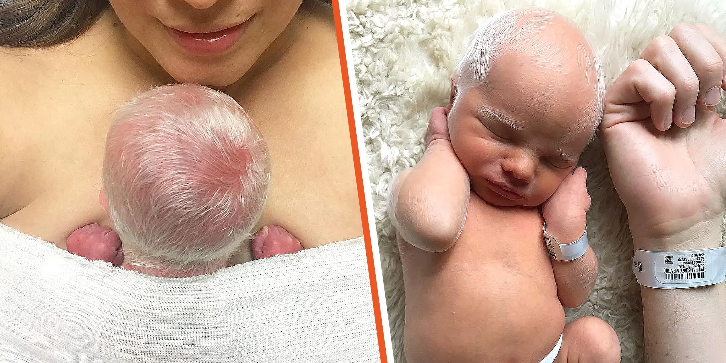 5. Baby mocked for having white hair – years later, he looks perfectly happy and healthy s2