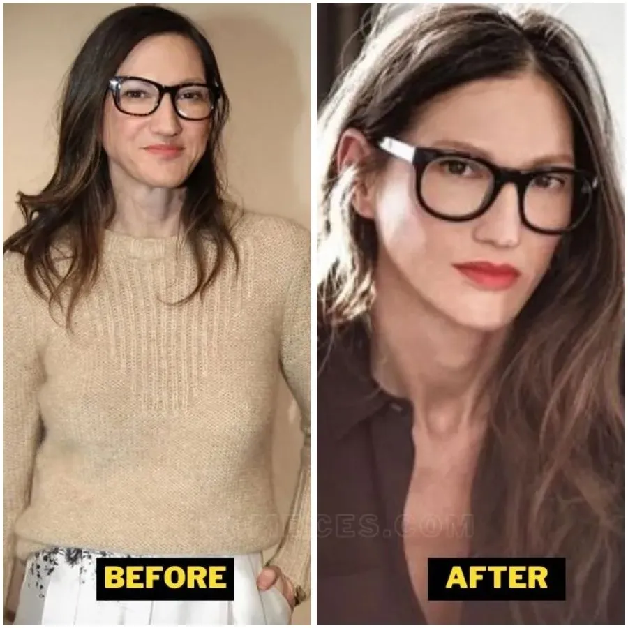 Jenna Lyons Says People Are Too ‘Judgmental’ About Cosmetic Surgery: Do ‘Whatever Works for You’