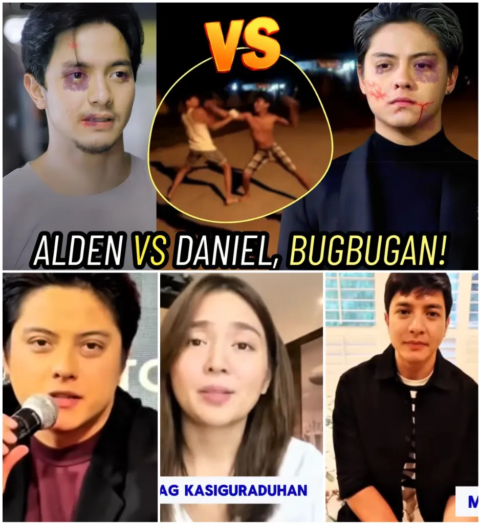 FAMOUS! ALDEN RICHARDS, INJURED AFTER BEING PUNCHED BY DANIEL PADILLA! KATHRYN, WORRIED ABOUT THEM and can no longer stand still