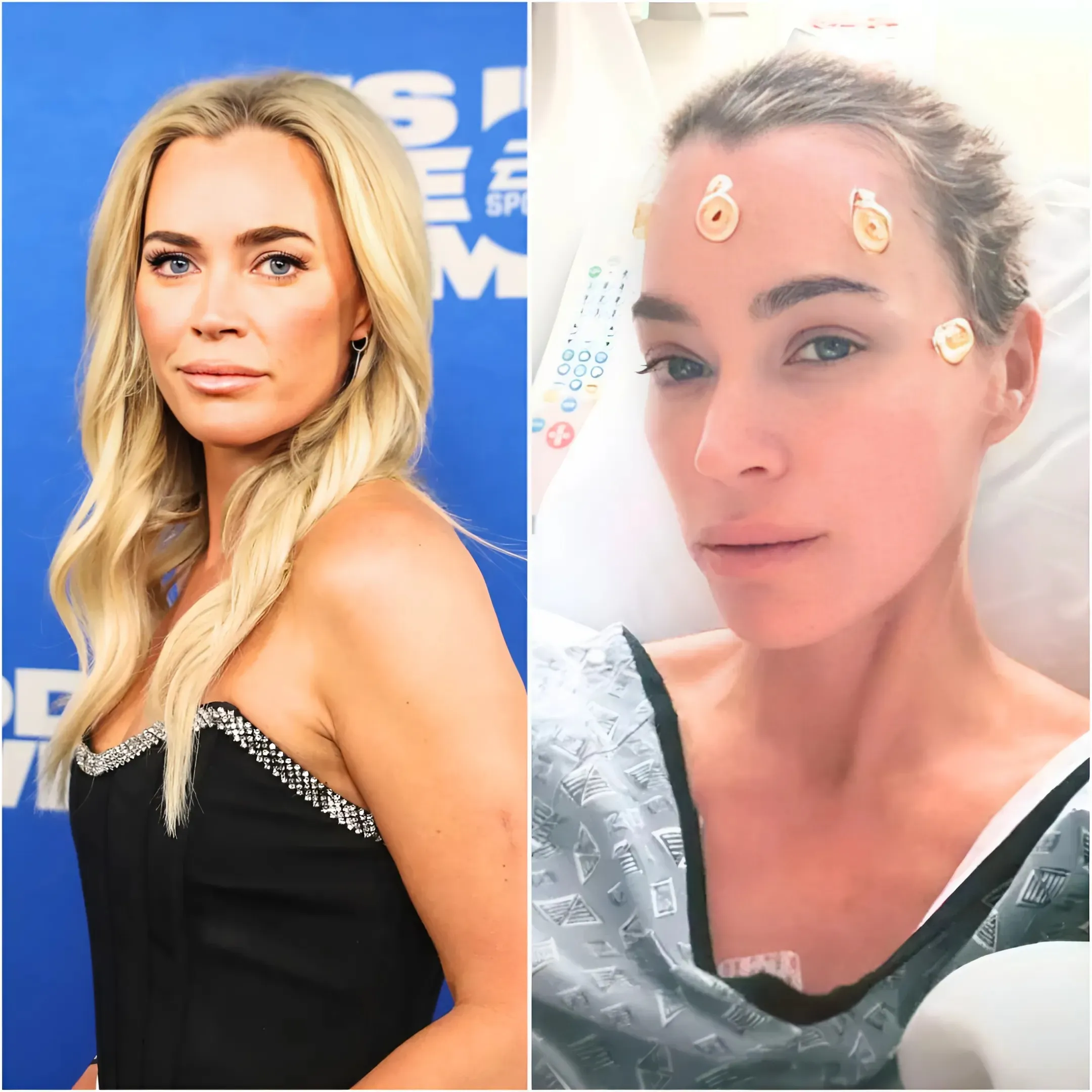 Teddi Mellencamp Faces ‘Long Tough Road’ Ahead After Brain Tumor Surgery, Plus RHOBH Alum Shares First Instagram Post Since Procedure