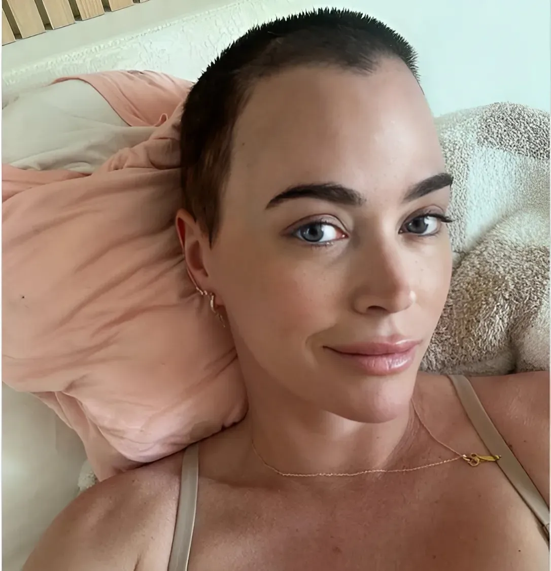 The #RHOBH alum shared an optimistic outlook for her recovery: "Feeling pretty good."