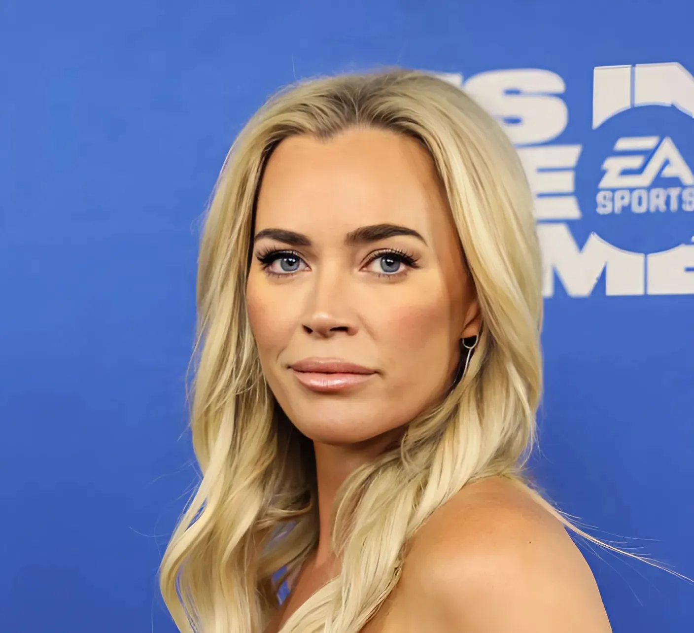 Teddi Mellencamp's Melanoma Cancer Has Spread: "I Will Win This Battle"