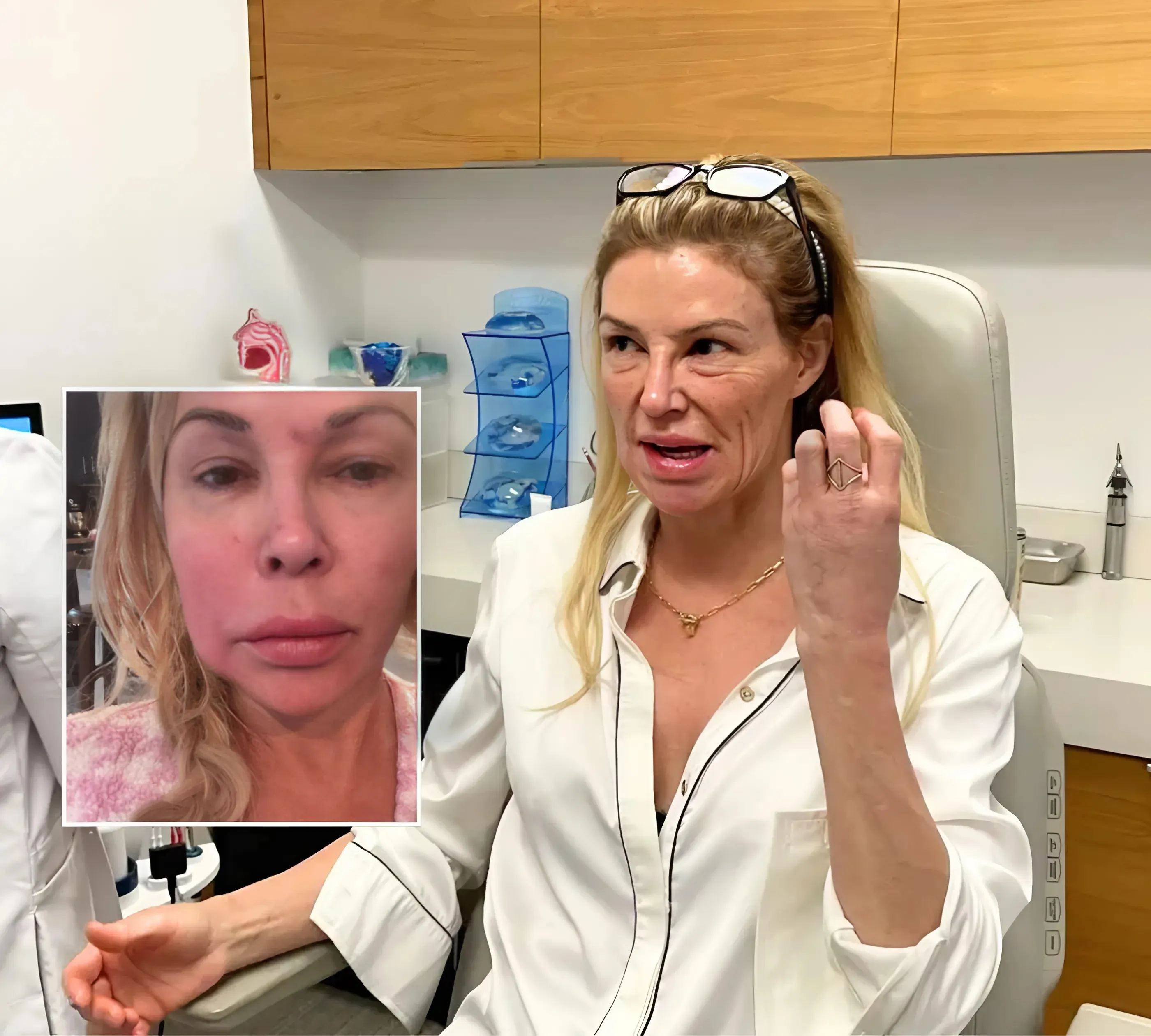 Brandi Glanville Says She’s “Miserable” as Face Has “Literally Melted Away,” Plus RHOBH Alum Shares Her Biopsy Results