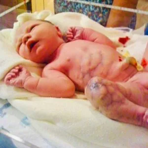 Mom delivers baby, forbidden from holding him when dad utters: “There’s something wrong with Adam’s leg”